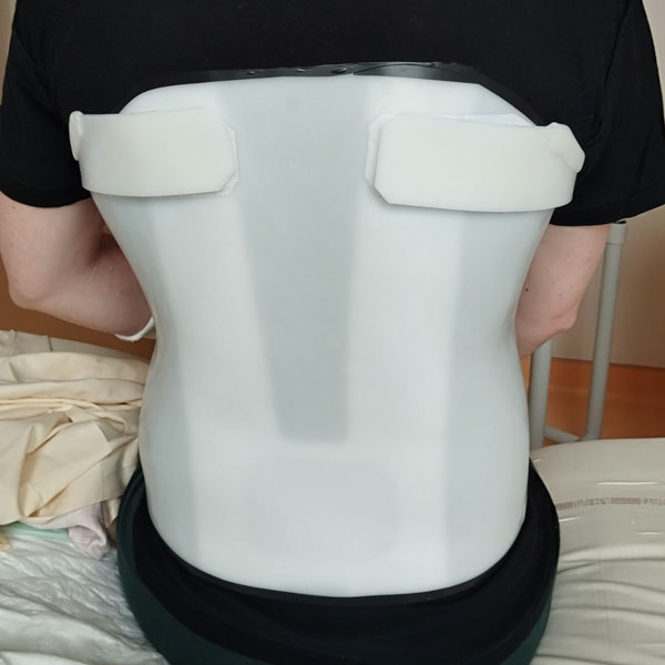 Orthopédie générale